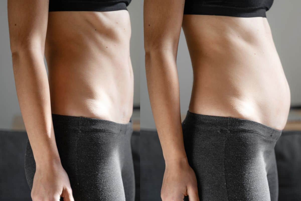 How long does diastasis recti take to improve West Barnes?