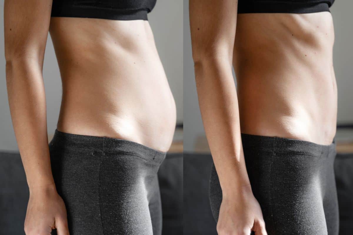Post-Pregnancy: What Happens to Your Abdominal Muscles After Birth West Barnes