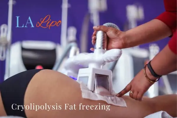 women getting fat freezing West Barnes