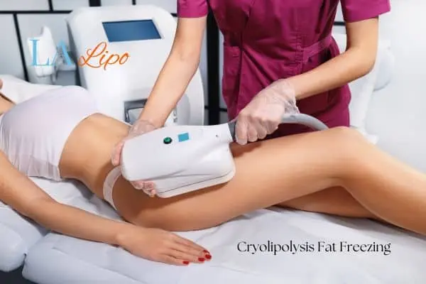 Woman receiving coolsculpting West Barnes treatment on her thighs