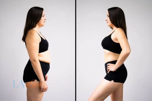 Picture of womans before and after using LA-EMS body sculpting to improve her core strength West Barnes