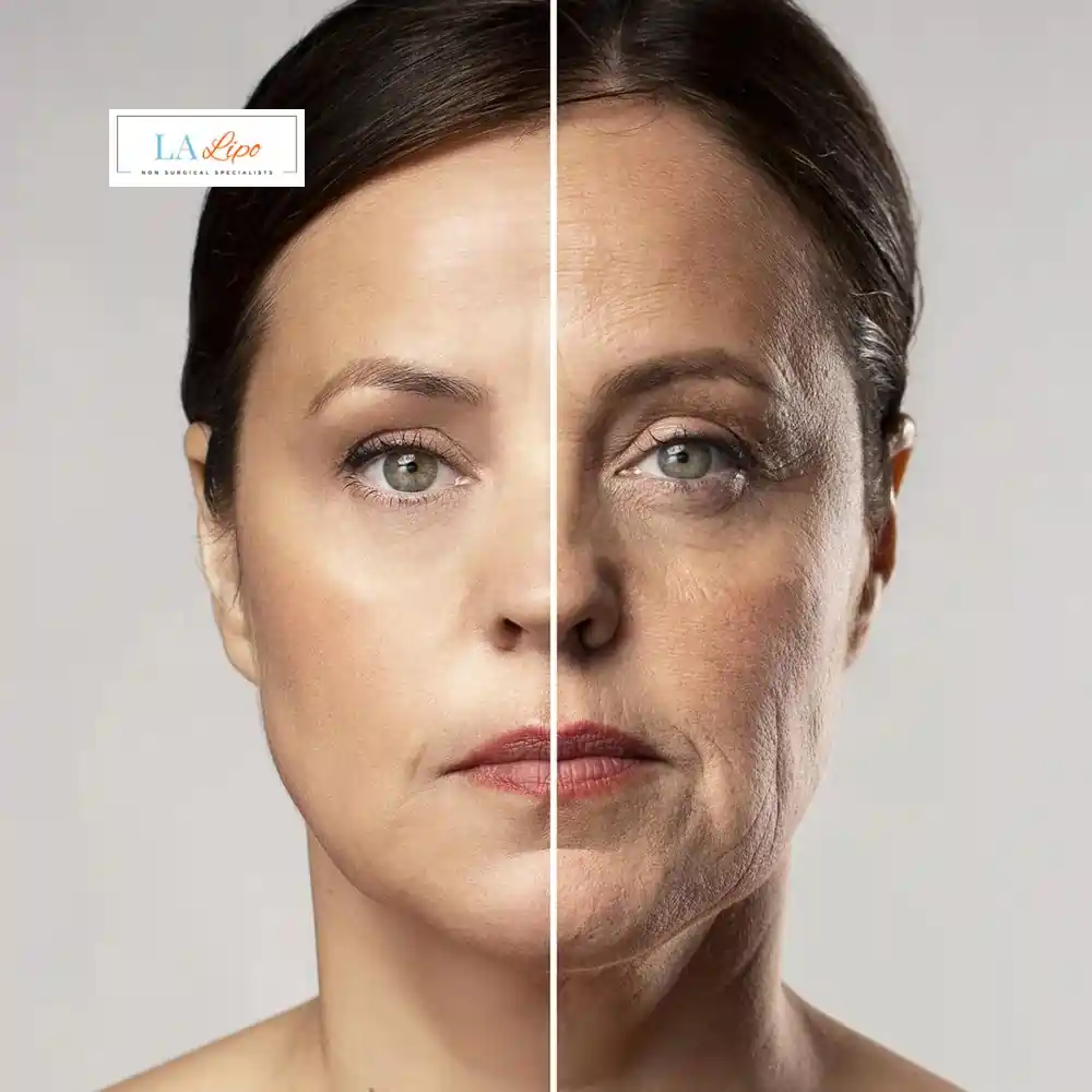 How Can You Tell If Non-Surgical Skin Tightening Is Right for You West Barnes?