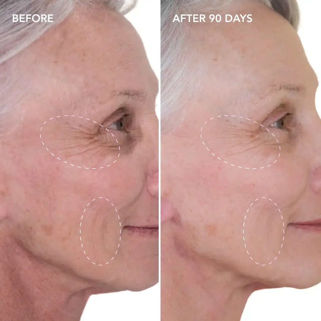 When will you see results West Barnes